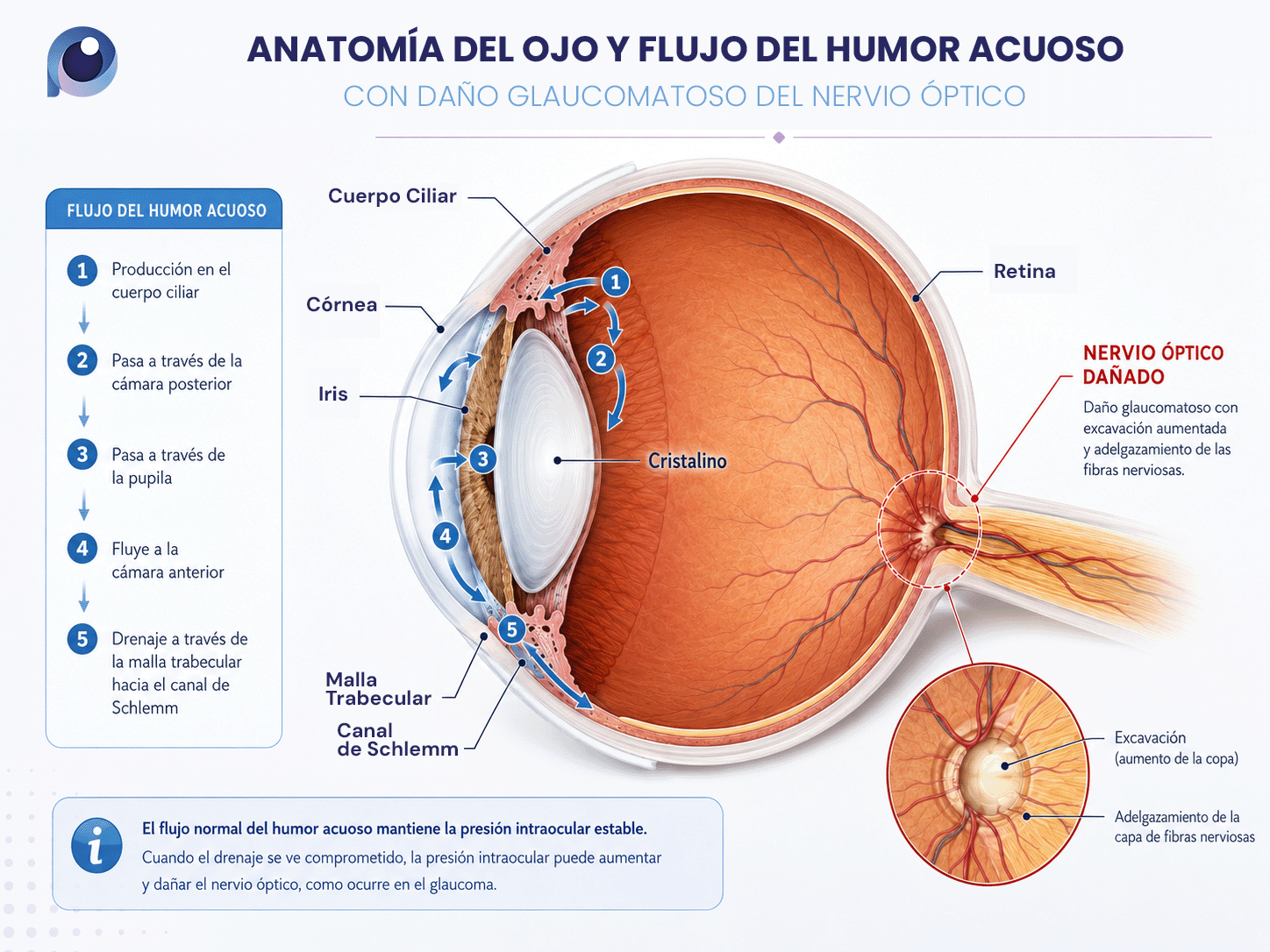 danoGlaucomatoso